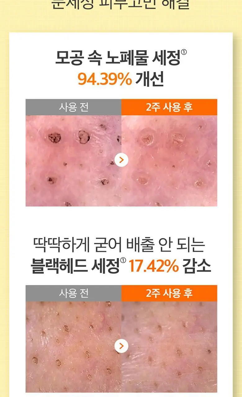 [대용량/올영단독] 넘버즈인 1번 말끔 순삭 클렌징 오일 400ml 대용량 상세페이지 18